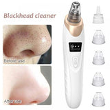 Electric Blackhead Suction Remover - Portable Pore Cleaner - Smart Blackhead Remover